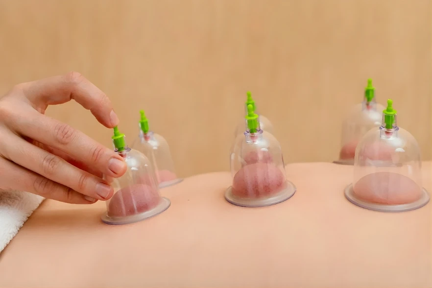 Cupping In Garland